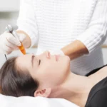 Kosmetische Behandlung mit einem SKINrePEN an einer Frau in einer hellen Praxisumgebung.